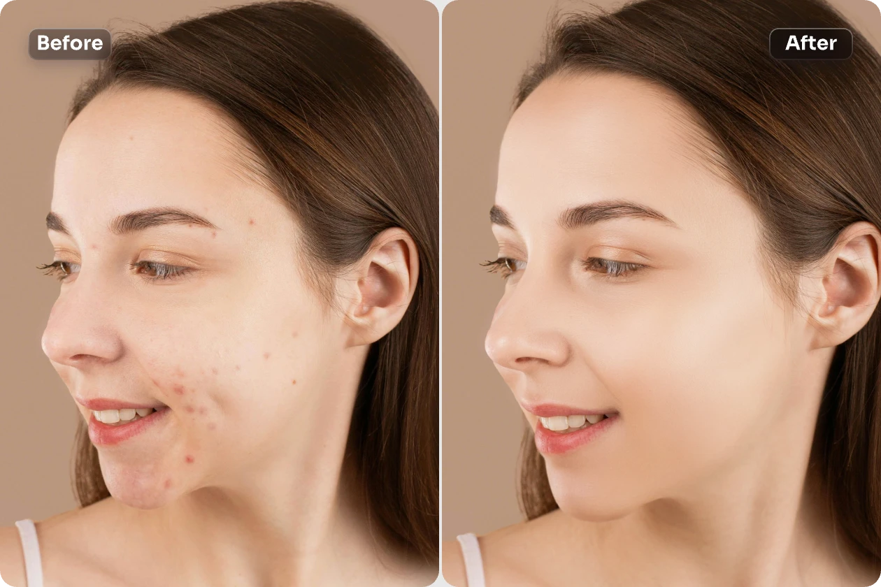 remove the acne from the woman face in aiease face editor